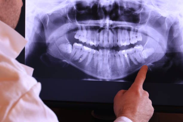Best Emergency Dental Care for Broken or Chipped Teeth in Broadway, VA